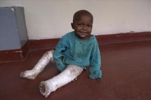 Ein Kind mit einem Verband um die Beine